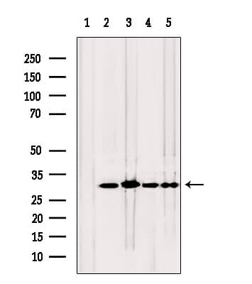 TPI1 / TPI Antibody