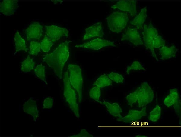 Monoclonal Mouse anti-Human CSNK2A1 Antibody (clone 3D9, IF, WB)