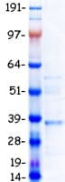 Human HOXA7 Protein (Recombinant Myc-DDK (Flag))