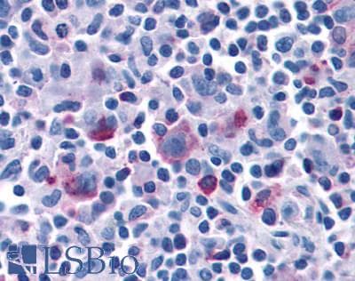 PathPlus™ CCR7 Antibody (C-Terminus)