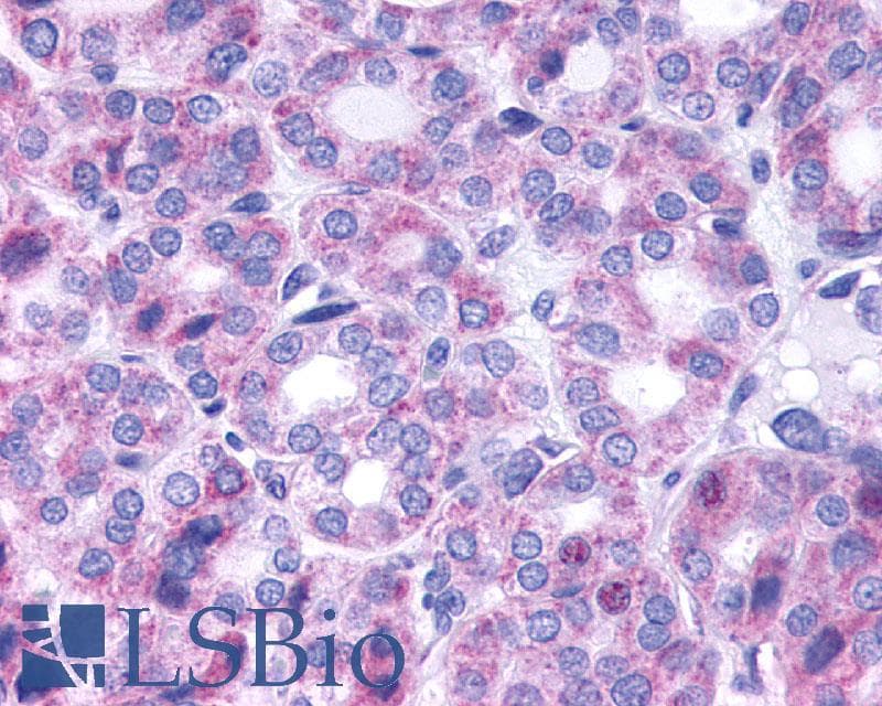 PathPlus™ TSH Receptor / TSHR Antibody (N-Terminus)