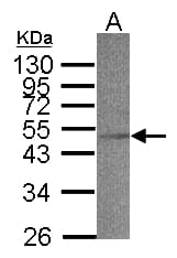 IHC-plus™ SCAD / ACADS Antibody