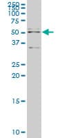 API5 Antibody (clone 1C2)