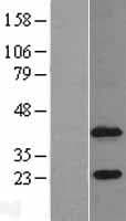 AGPAT4 Protein (Over-Expression Lysate Myc-DDK (Flag))