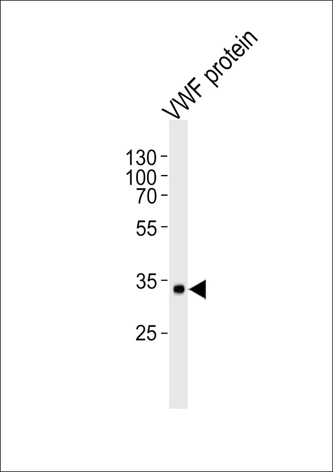 VWF / Von Willebrand Factor Antibody (clone 907CT12.1.9)