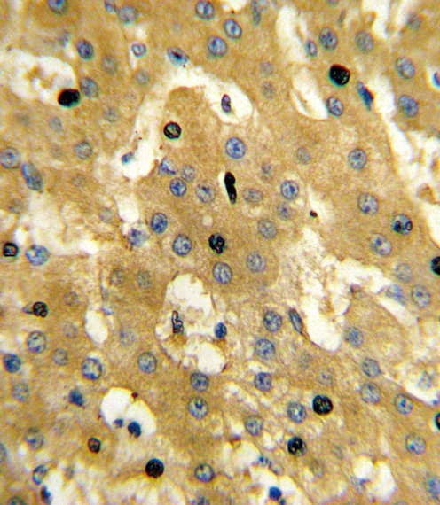 SCP2 / SCPX Antibody (aa358-385)