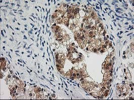 OSBP Antibody (clone OTI1A4)