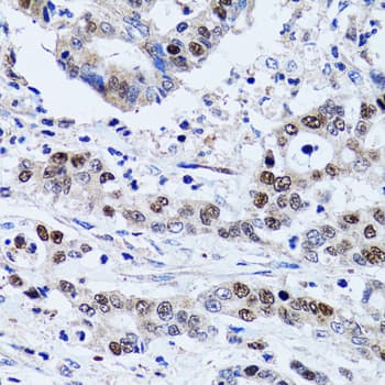 UHRF1 Antibody