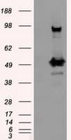 Monoclonal Mouse anti-Human PSMC3 Antibody (clone OTI1C10, IHC, IF, WB)