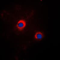 HSP90B1 / GP96 / GRP94 Antibody (C-Terminus)
