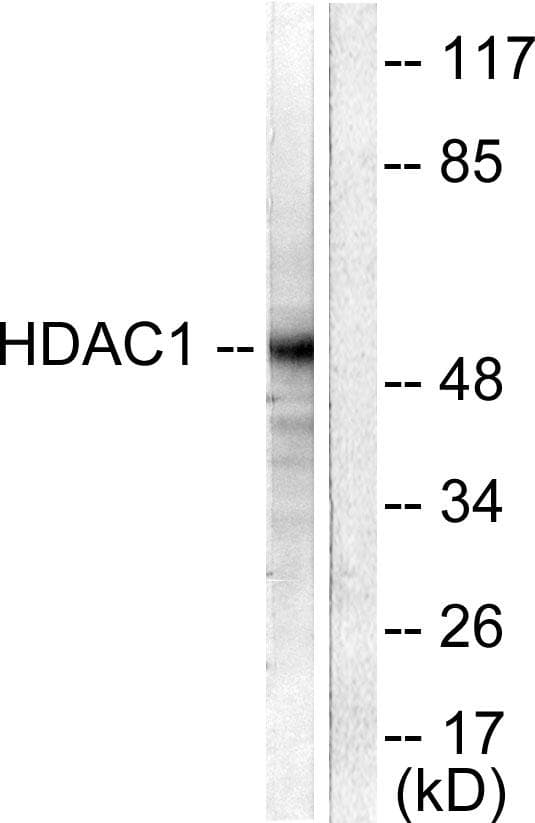 Polyclonal Rabbit anti-Human HDAC1 Antibody (IHC, IF, WB)