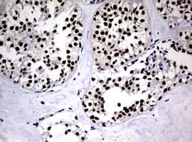 PCNA Antibody (clone OTI6B6)