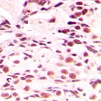 LMNA / Lamin A+C Antibody (Internal)