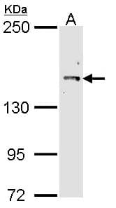 Polyclonal Rabbit anti-Human CUL7 Antibody (aa1370-1698, IHC, WB)
