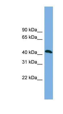 ANKMY2 Antibody (aa107-156)
