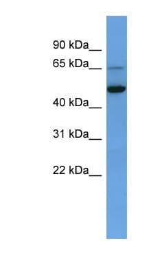 IQCB1 Antibody (aa357-406)