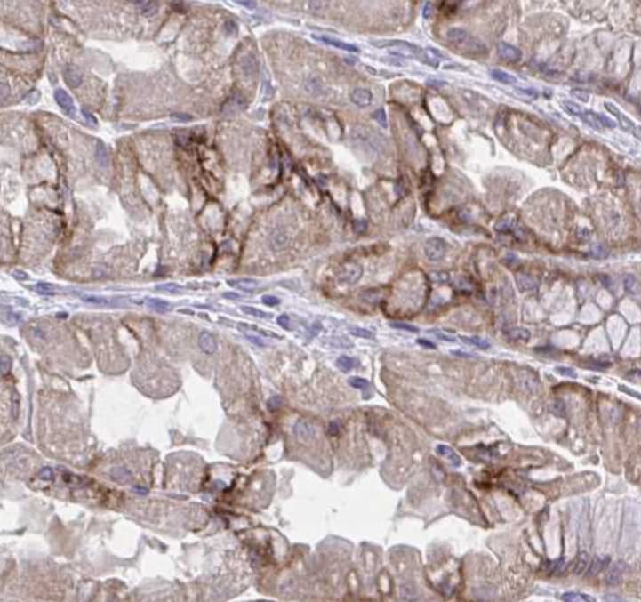 Polyclonal Rabbit anti-Human IL8 / Interleukin 8 Antibody (IHC, WB)