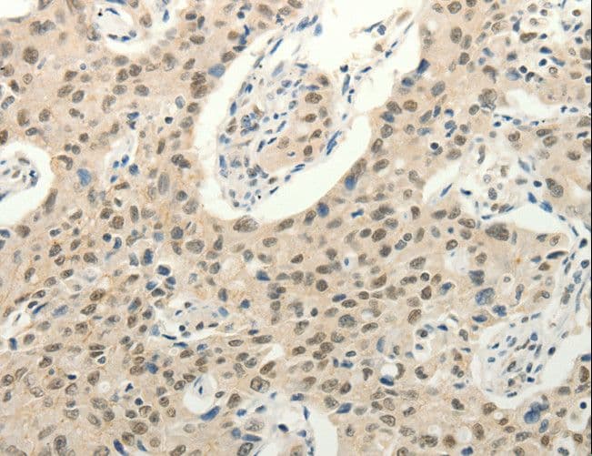 FZD10 / Frizzled 10 Antibody
