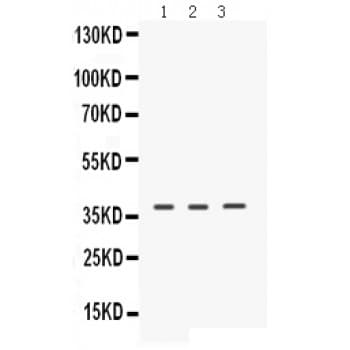 ERVWE1 / HERV / Syncytin Antibody (aa406-435)