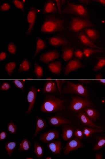 POLB / DNA Polymerase Beta Antibody