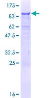 Human Ameloblastin / AMBN Protein (Recombinant GST)