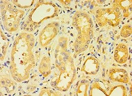 ENTPD5 / CD39L4 Antibody (aa149-428)