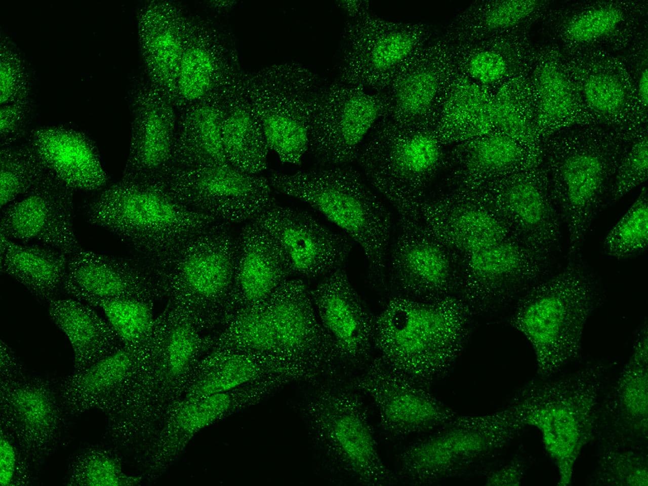 Polyclonal Rabbit anti-Human LRWD1 Antibody (IF)