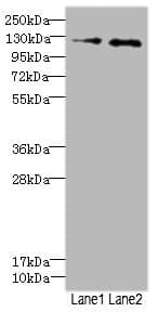 Polyclonal Rabbit anti-Human HEPH / Hephaestin Antibody (IHC, WB)