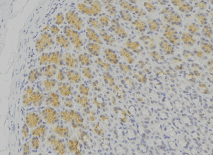HLA-DPB1 Antibody