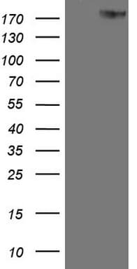 ERBB3 / HER3 Antibody (aa983-1342, clone OTI3C1)