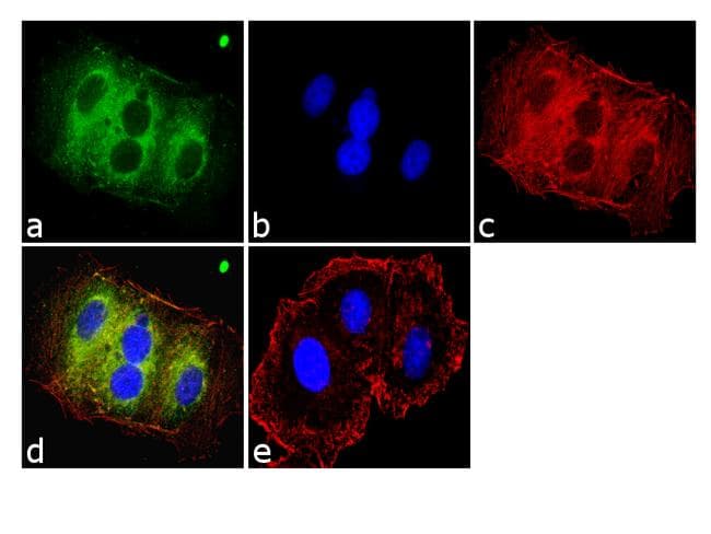 Monoclonal Mouse anti-Human KRAS Antibody (clone 9.13, C-Terminus, IHC, IF, WB)