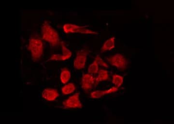 KRT15 / CK15 / Cytokeratin 15 Antibody