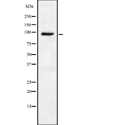 TRPV4 Antibody (aa847-867)