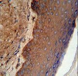 KRT9 / CK9 / Cytokeratin 9 Antibody (aa302-331)