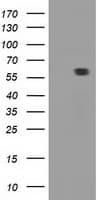 Monoclonal Mouse anti-Human DTNA / Dystrobrevin Alpha Antibody (clone OTI1B11, IF, WB)