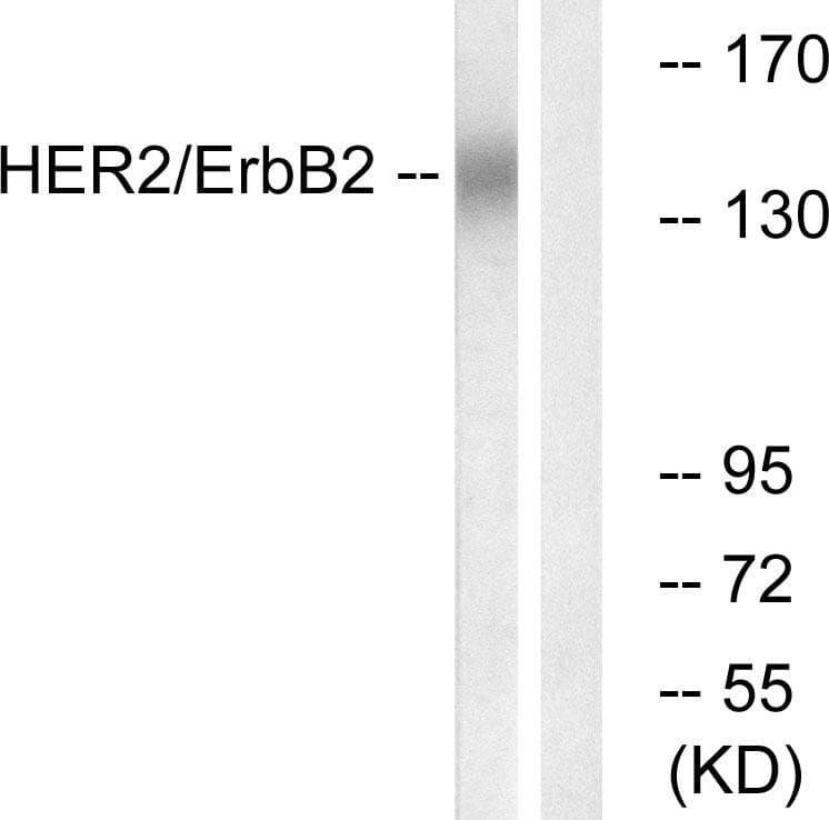 ERBB2 / HER2 Antibody (p686)