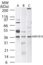 IHC-plus™ Polyclonal Rabbit anti-Human AKR1B10 Antibody (aa100-200, IHC, WB)