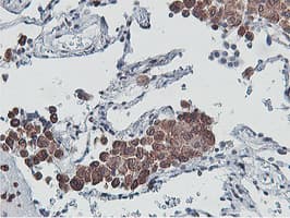 APMAP / C20orf3 Antibody (clone OTI3F2)