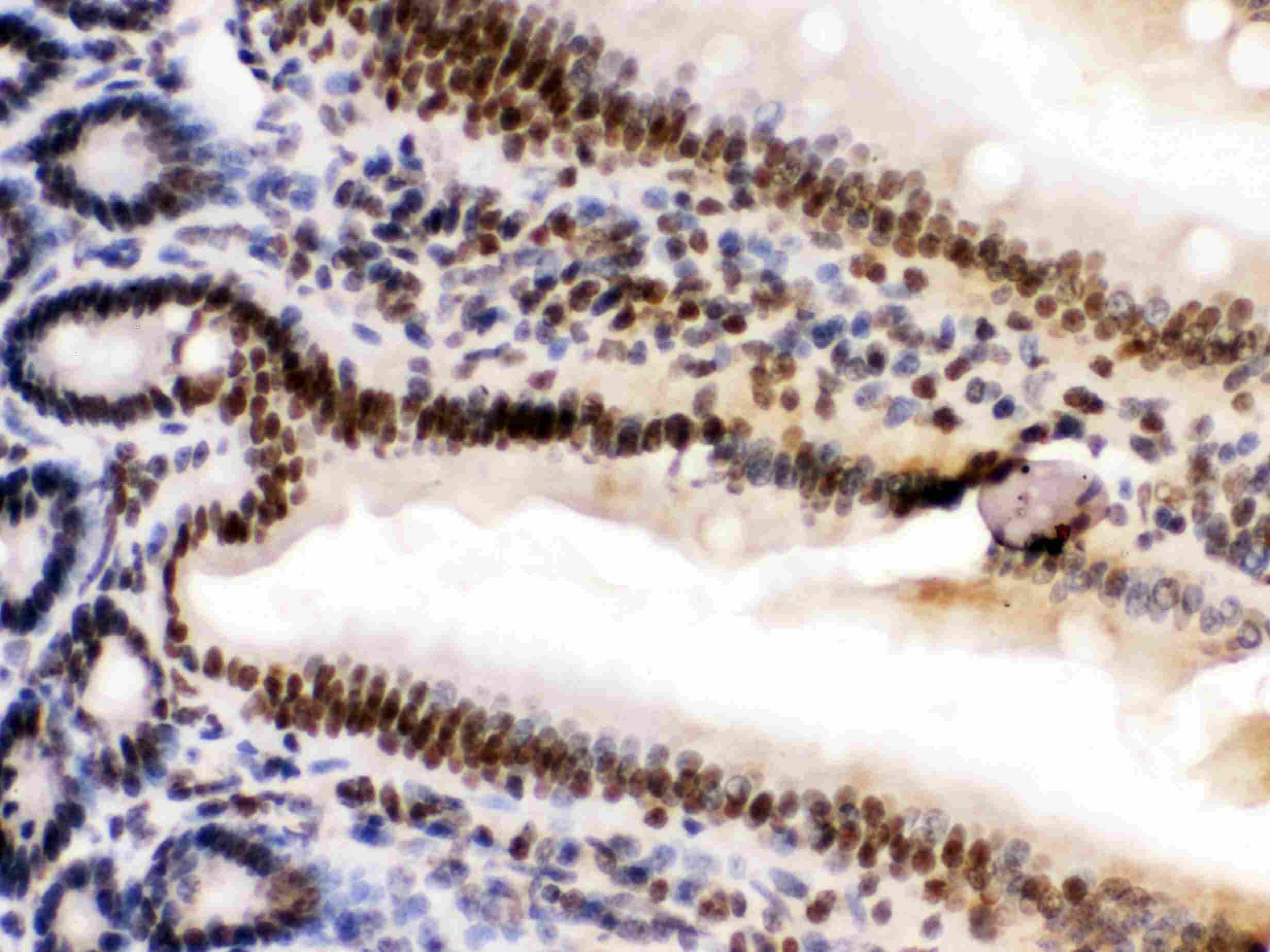 HMG2 / HMGB2 Antibody