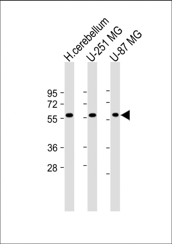 SHC2 / SLI Antibody (N-Terminus)