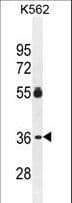 Polyclonal Rabbit anti-Human PRSS48 / ESSPL Antibody (aa85-114, WB)