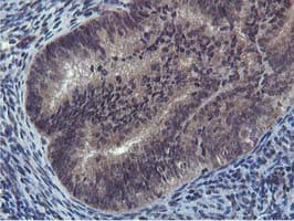 Cystatin SA / CST2 Antibody (clone OTI1D6)