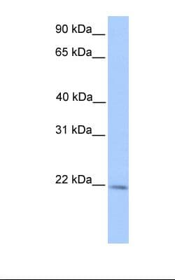 PathPlus™ AGR2 Antibody (aa101-150)