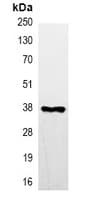 DYKDDDDK Tag Antibody