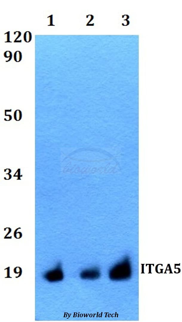 ITGA5/Integrin Alpha 5/CD49e Antibody