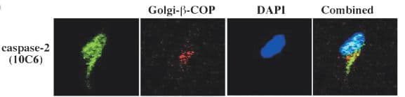CASP2 / Caspase 2 Antibody (clone 10C6)