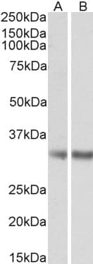 IHC-plus™ Polyclonal Goat anti-Human MGLL / Monoacylglycerol Lipase Antibody (aa17-29, IHC, WB)