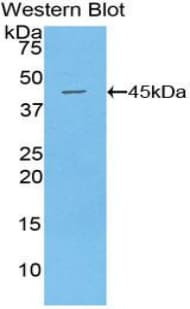 EMA / MUC1 Antibody (aa410-525, Cy3)