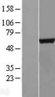 CTU2 Protein (Over-Expression Lysate Myc-DDK (Flag))