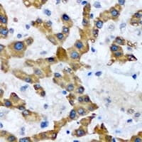HAO1 Antibody